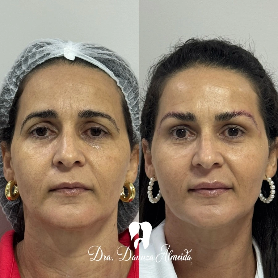 Cirurgia de Castanhares - Imagem 1