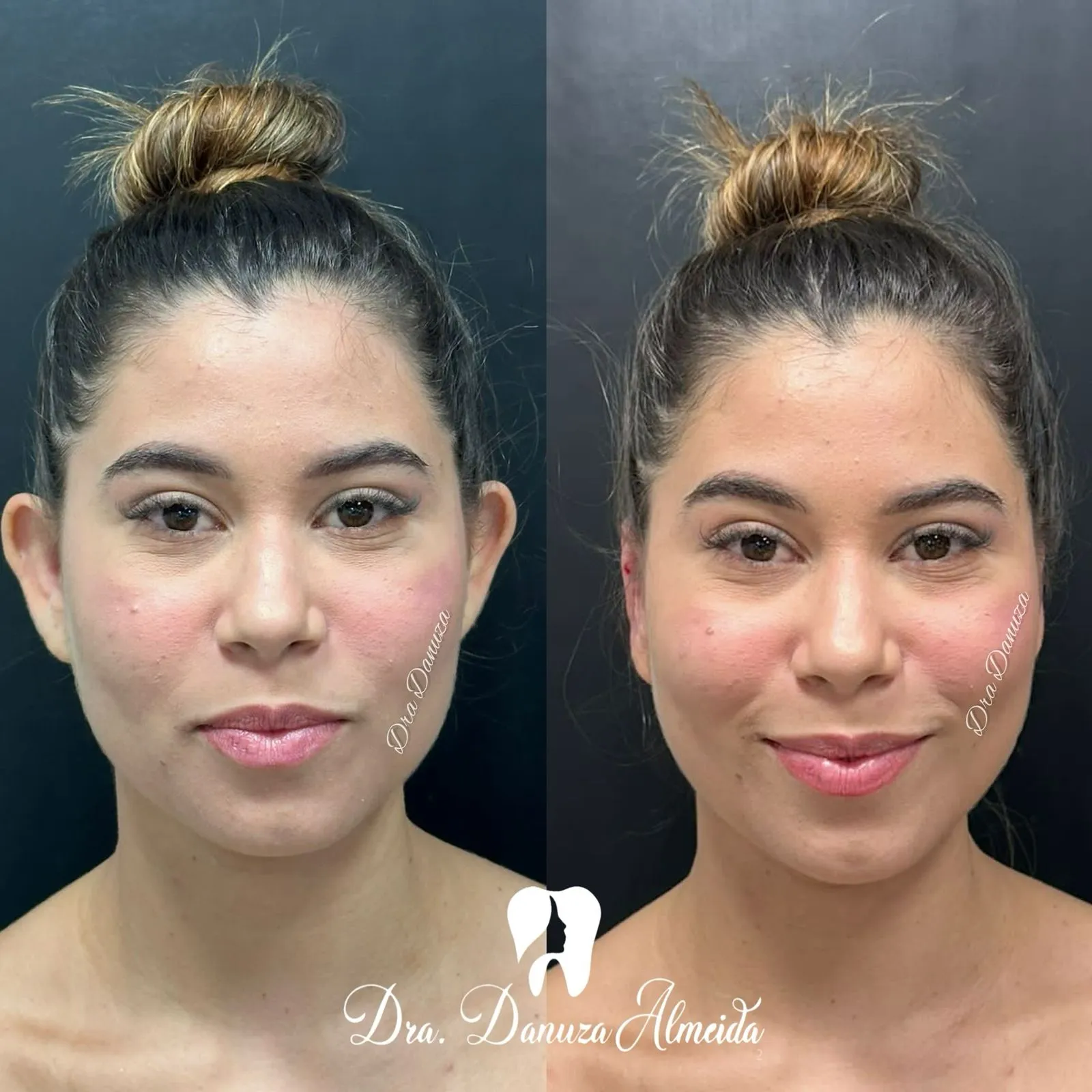 Otomodelação - Imagem 1